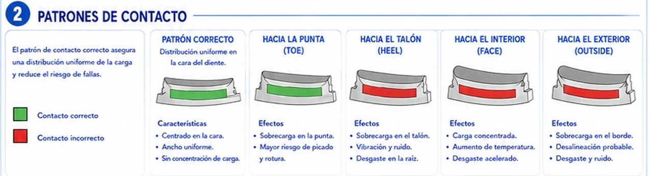 Patrones de contacto de un diente: correcto, hacia la punta, hacia el talón, hacia el interior y hacia el exterior